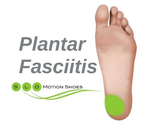 Plantar-fasciitis-website-updated