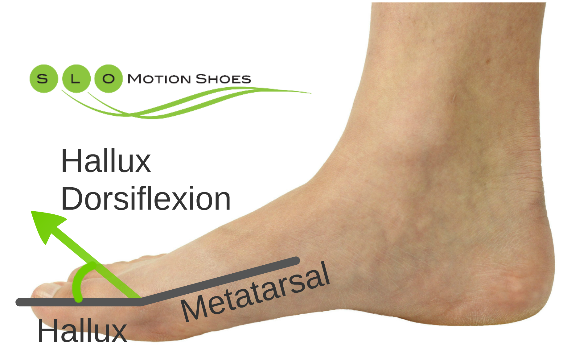 hallux-dorsiflexion-slo-motion-shoesslo-motion-shoes