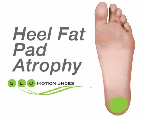 Heel-Fat-Pad-Atrophy