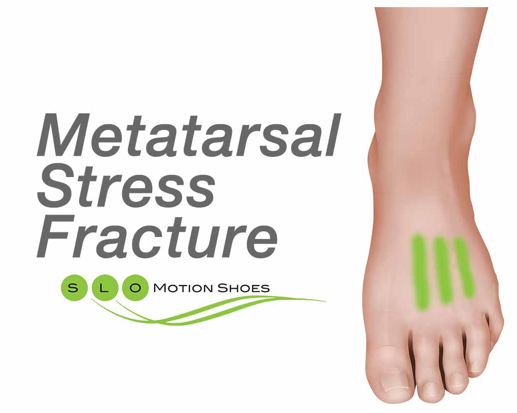 Stress fracture. Metatarsal Protection.