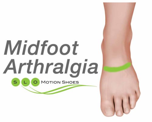 Midfoot-Arthralgia