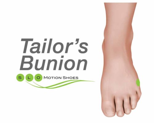 Tailor's-Bunion